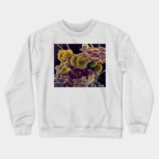 MRSA ingestion by white blood cell, SEM (C021/7464) Crewneck Sweatshirt